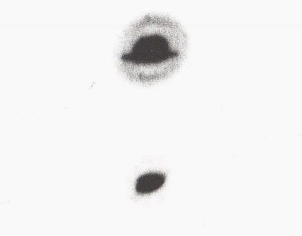 Wicie 03.9.1983.  UFO v tvare klobúka so žltou žiarou a opúšťajúce sa 