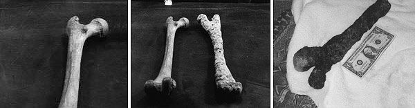 Mineralizované kosti. Jedna z mnoha nalezených na místě přechodu, vedle současné rovnocenné kosti. Je v podstatě 